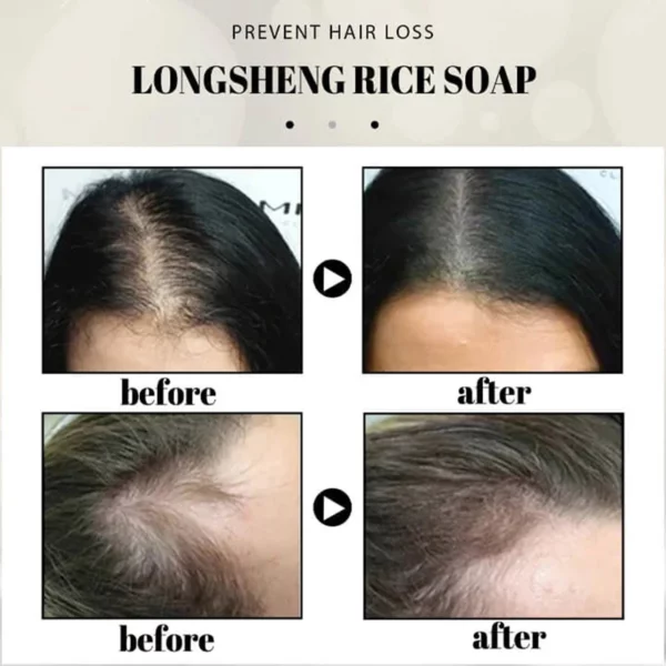1pc Solid Rice Shampoo Bar Citrus Scent Hair Growth Shampoo Soap Hair Regrow Shampoos Moisturizing Anti Hair Loss Treatments - Image 5