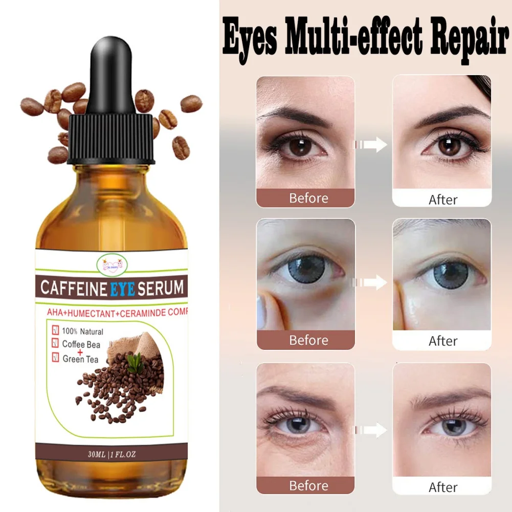 %name 30ml Caffeine Eye Serum Anti Wrinkle Removal Bag Eye Dark Circle Anti Aging Fade Fine Line Puffiness Essence Beauty Health Care